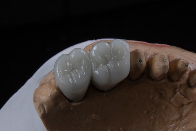 Implantes dentales de zirconio vs titanio