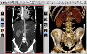 3dicom_8